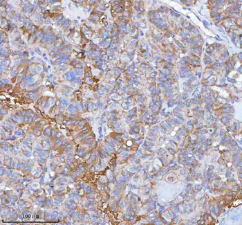 hIST1/IST1 Rabbit Polyclonal Antibody