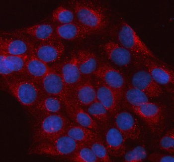 hIST1/IST1 Rabbit Polyclonal Antibody