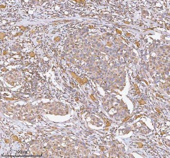 hIST1/IST1 Rabbit Polyclonal Antibody