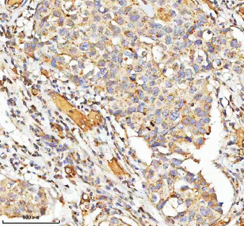 hIST1/IST1 Rabbit Polyclonal Antibody