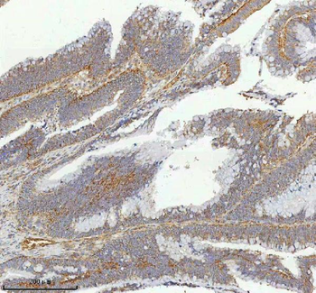 hIST1/IST1 Rabbit Polyclonal Antibody