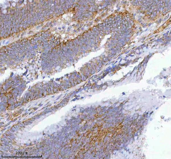 hIST1/IST1 Rabbit Polyclonal Antibody