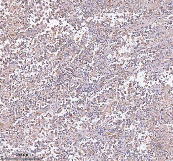 hIST1/IST1 Rabbit Polyclonal Antibody