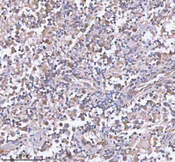 hIST1/IST1 Rabbit Polyclonal Antibody