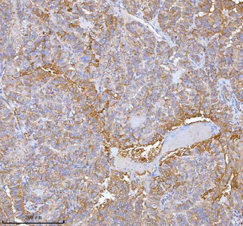 hIST1/IST1 Rabbit Polyclonal Antibody
