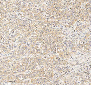 HDHD2 Rabbit Polyclonal Antibody