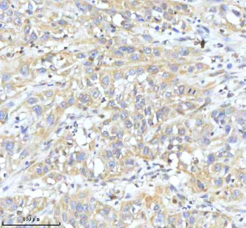 HDHD2 Rabbit Polyclonal Antibody