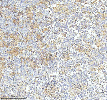 HDHD2 Rabbit Polyclonal Antibody