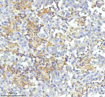 HDHD2 Rabbit Polyclonal Antibody