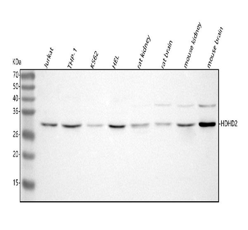 HDHD2 Rabbit Polyclonal Antibody