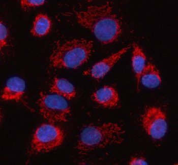 HDGFL2 Rabbit Polyclonal Antibody