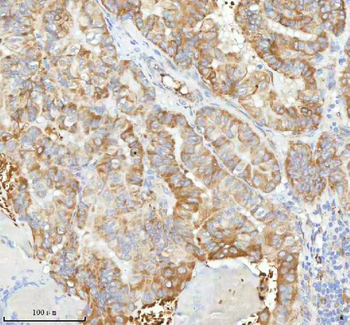 HAGH Rabbit Polyclonal Antibody