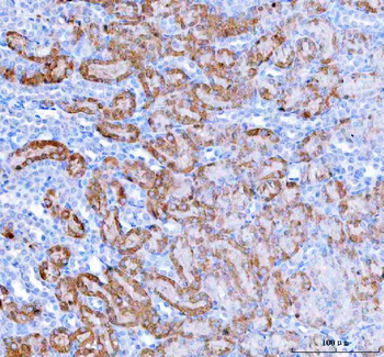 HAGH Rabbit Polyclonal Antibody