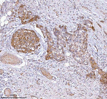 HAGH Rabbit Polyclonal Antibody