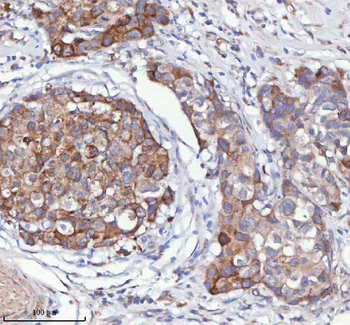 HAGH Rabbit Polyclonal Antibody