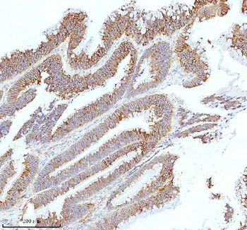 HAGH Rabbit Polyclonal Antibody