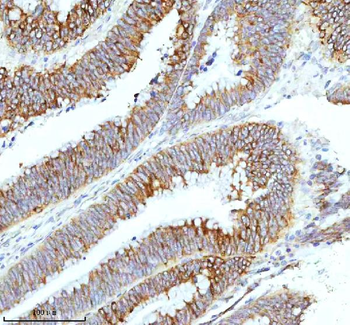 HAGH Rabbit Polyclonal Antibody