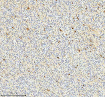 HAGH Rabbit Polyclonal Antibody
