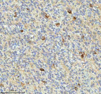 HAGH Rabbit Polyclonal Antibody