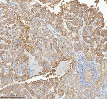 HAGH Rabbit Polyclonal Antibody