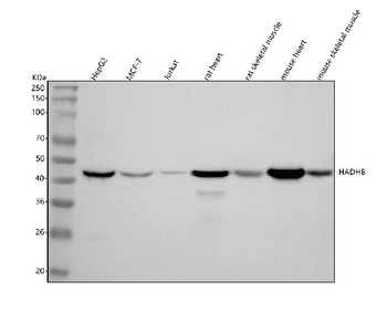 HADHB Antibody