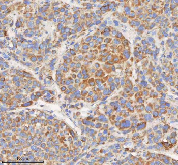 HADHB Antibody