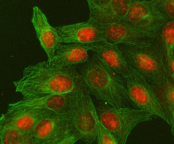 H2AFY2/MACROH2A2 Rabbit Polyclonal Antibody