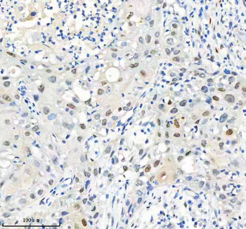 H2AFY2/MACROH2A2 Rabbit Polyclonal Antibody