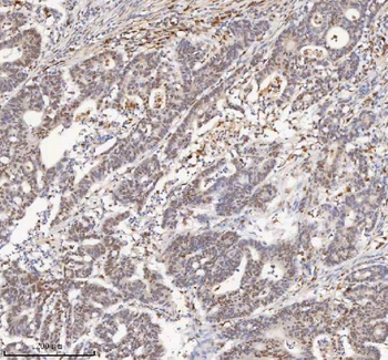 H2AFY/MACROH2A1 Rabbit Polyclonal Antibody