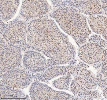 H2AFY/MACROH2A1 Rabbit Polyclonal Antibody