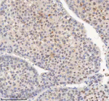 H2AFY/MACROH2A1 Rabbit Polyclonal Antibody