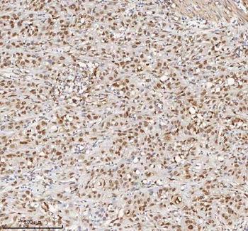 H2AFY/MACROH2A1 Rabbit Polyclonal Antibody