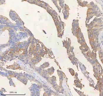 SCD Rabbit Polyclonal Antibody