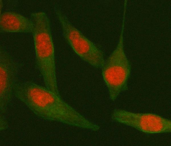 TDP-43/TARDBP/TDP Rabbit Polyclonal Antibody