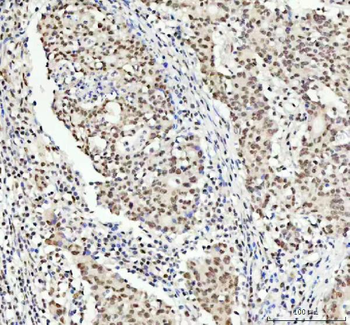 TDP-43/TARDBP/TDP Rabbit Polyclonal Antibody