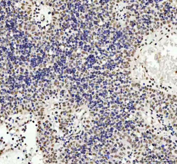 TDP-43/TARDBP/TDP Rabbit Polyclonal Antibody