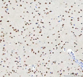 TDP-43/TARDBP/TDP Rabbit Polyclonal Antibody