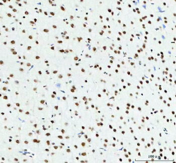 TDP-43/TARDBP/TDP Rabbit Polyclonal Antibody