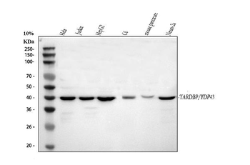 TDP-43/TARDBP/TDP Rabbit Polyclonal Antibody