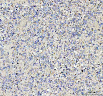 Tenascin-R TNR Rabbit Polyclonal Antibody