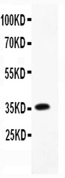 Macrophage Inflammatory Protein 1 beta/CCL4 Rabbit Polyclonal Antibody