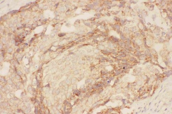 Eotaxin 3/CCL26 Rabbit Polyclonal Antibody