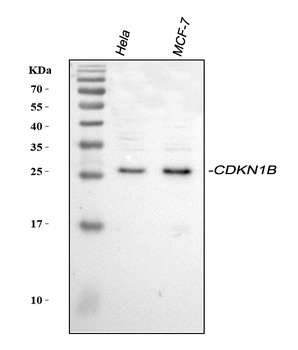 p27 KIP 1/CDKN1B Rabbit Polyclonal Antibody