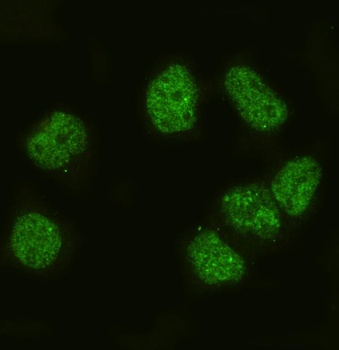 p27 KIP 1/CDKN1B Rabbit Polyclonal Antibody