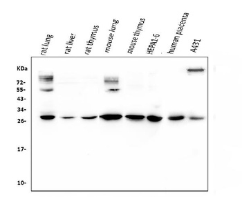 VEGF/VEGFA Rabbit Polyclonal Antibody