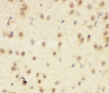 CBL Rabbit Polyclonal Antibody