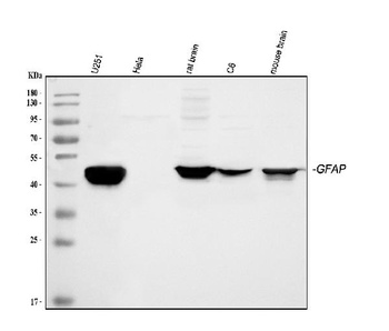 GFAP Rabbit Polyclonal Antibody