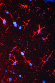 GFAP Rabbit Polyclonal Antibody