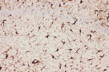 GFAP Rabbit Polyclonal Antibody