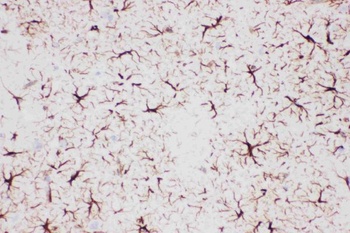 GFAP Rabbit Polyclonal Antibody